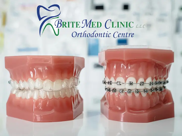Orthodontic and dental services at BriteMed Clinic